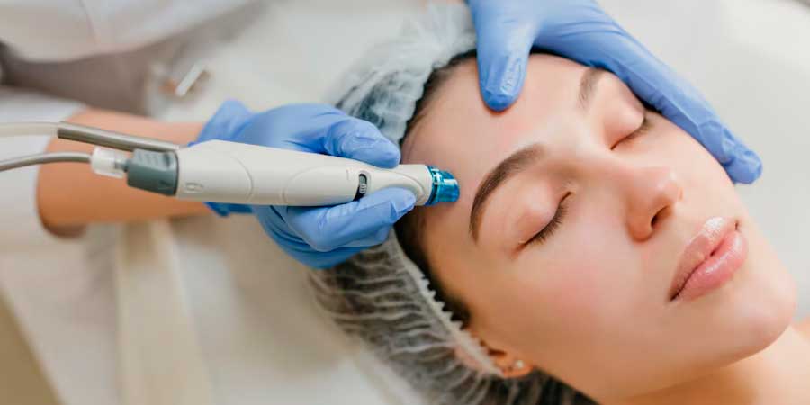 Exosomas + Microneedling: el tratamiento antiedad más avanzado